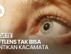 Praktisi Medis Spesialis Mata Sebut Softlens Tidak Bisa Gantikan Fungsi Kacamata