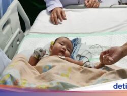 Praktisi Medis RSU Soetomo Pisahkan Kembar Siam Dempet Bokong, Satu Bayi Meninggal